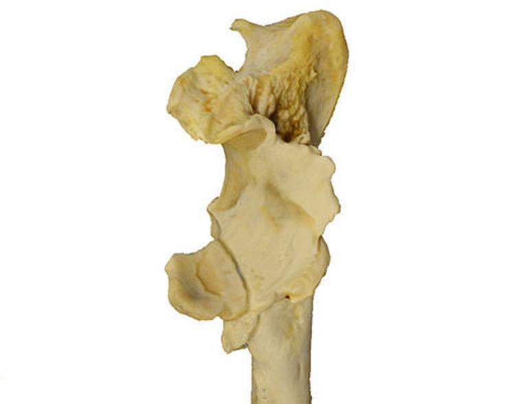 The end of an elbow bone.