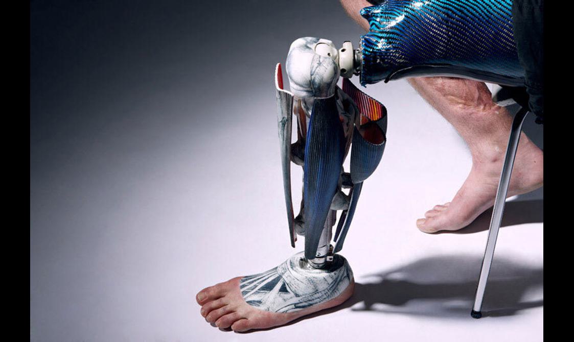 A model wearing a prosthetic leg and foot with an anatomical design.