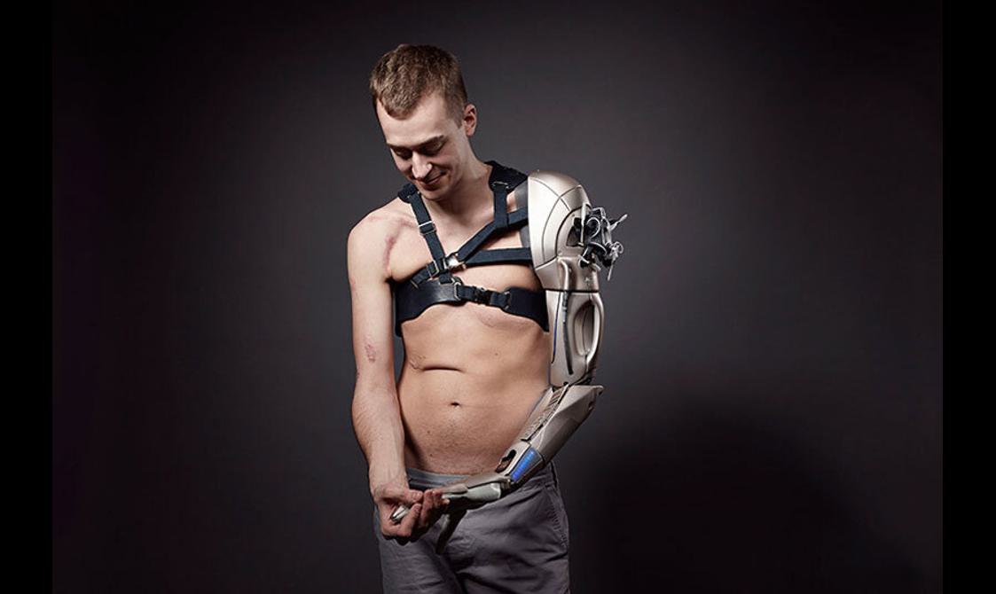 A model wearing a prosthetic arm designed like a silver bionic limb.